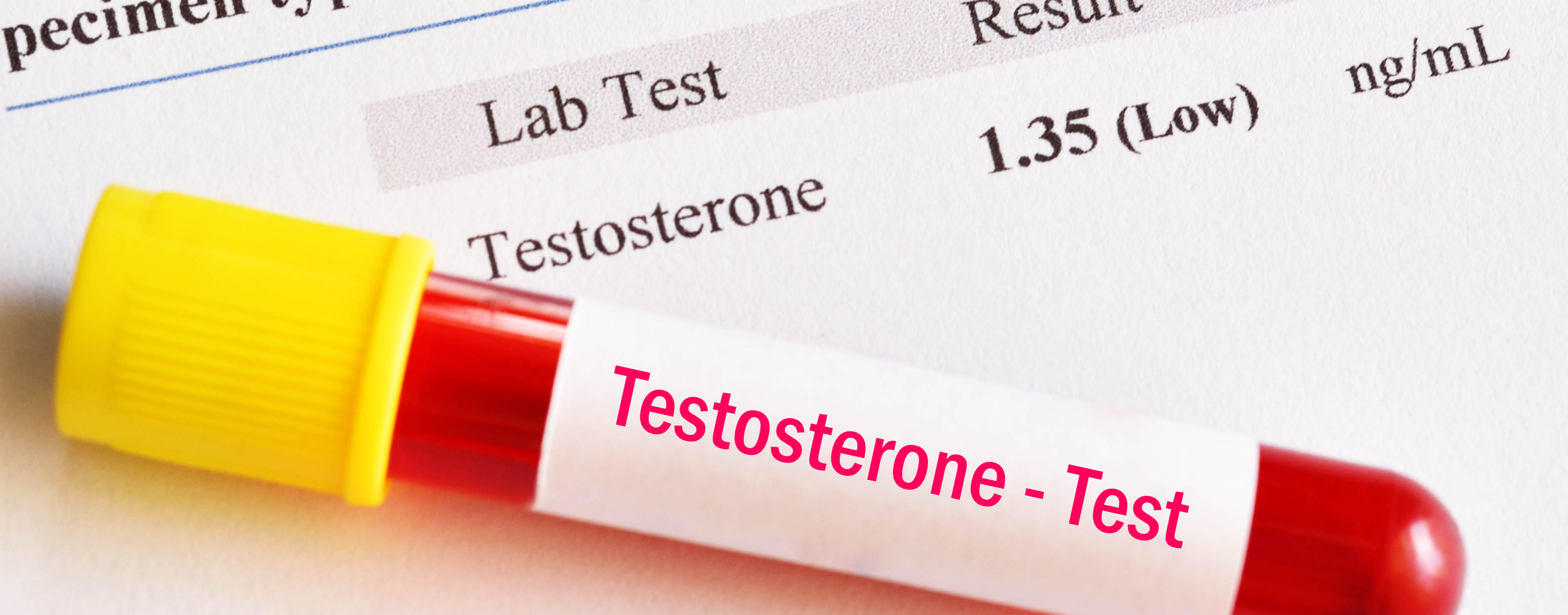 testosterone_low